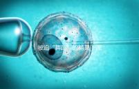 被迫“舞蹈”的精靈！深度了解亨廷頓舞蹈癥是什么病