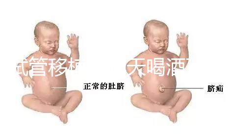 試管移植前幾天喝酒了有影響嗎？想要懷孕得管住嘴！