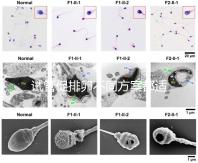 試管促排卵不同方案都適合哪些人？如何監測排卵？
