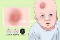 試管嬰兒現(xiàn)在多少錢