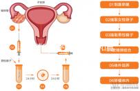試管嬰兒的具體步驟和具體花費（一代試管生男孩的經驗）