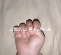 試管嬰兒的具體步驟和技術(shù)細(xì)節(jié)（試管嬰兒的具體步驟和技術(shù)細(xì)節(jié)是什么）