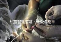 試管嬰兒答疑:什么情況下需要進(jìn)行PGS和PGD?