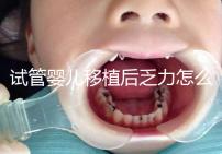 試管嬰兒移植后乏力怎么回事？匡延平主任告訴你答案