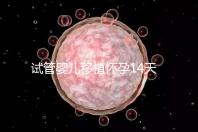 試管嬰兒移植懷孕14天，還能吃巧克力餅干嗎？