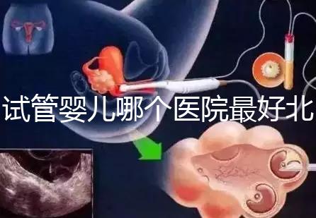 試管嬰兒哪個醫院最好北京（試管嬰兒北京哪個醫院做的好）