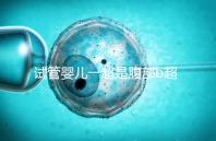 試管嬰兒一超是腹部b超還是陰超要早知，二者區(qū)別大請(qǐng)注意