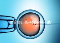 試管嬰兒孩子好不好(試管嬰兒孩子好嗎)