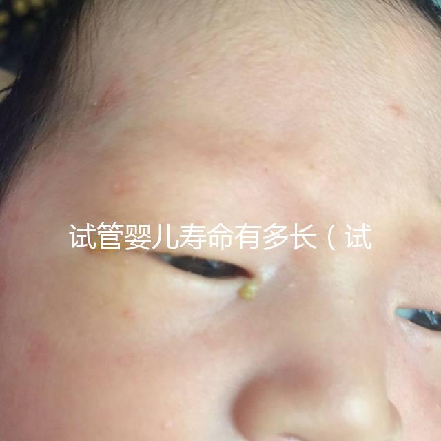 試管嬰兒壽命有多長(zhǎng)（試管嬰兒壽命有多長(zhǎng)時(shí)間）