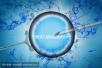 試管嬰兒建檔需要多長時間進來瞧，內含詳細流程供參考