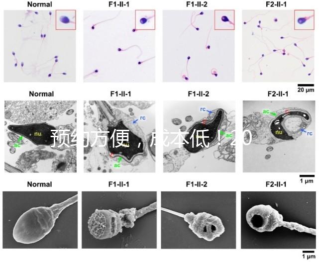 預約方便，成本低！2024年西安新城、臨潼、雁塔四維彩超指南