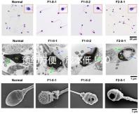 預(yù)約方便，成本低！2024年西安新城、臨潼、雁塔四維彩超指南