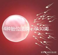 4種胎位圖解,孕30周這個(gè)姿勢(shì)最適合順產(chǎn)