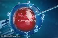 45歲懷孕藥流有風(fēng)險!這4種并發(fā)癥極易影響安全