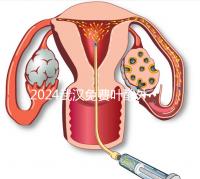 2024武漢免費(fèi)葉酸外國人可以領(lǐng)取,符合條件就來江漢區(qū)