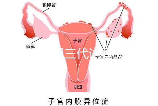 2025昆明三代試管助孕機構(gòu)收費明細，價格8萬至15萬不等